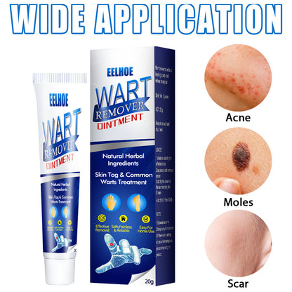 Zhongcao Keyou Liquid Skin Warts Ordinary Yukeyou Skin care lotion Wart Removing Cream