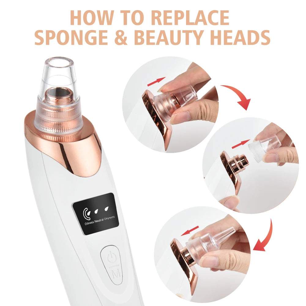 Blackhead Remover Vacuum | Electric Blackhead Remover | My Store