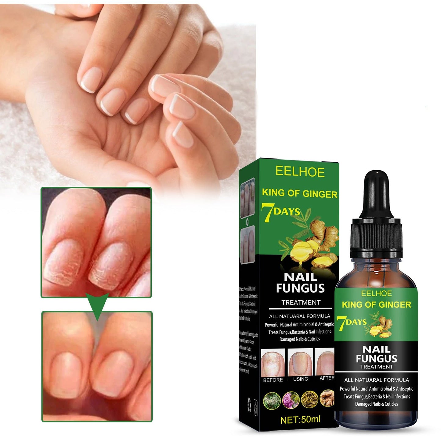 Nail Repair Solution Hand Foot And Nail Care Solution