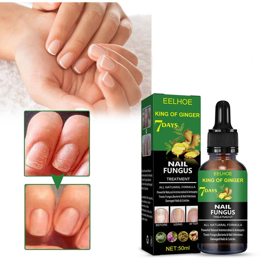 Nail Repair Solution Hand Foot And Nail Care Solution