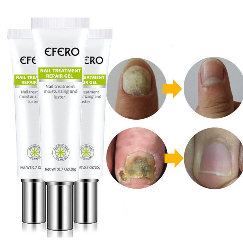 Nail Treatment Serum Nail Foot Nail Fungus Removal Gel