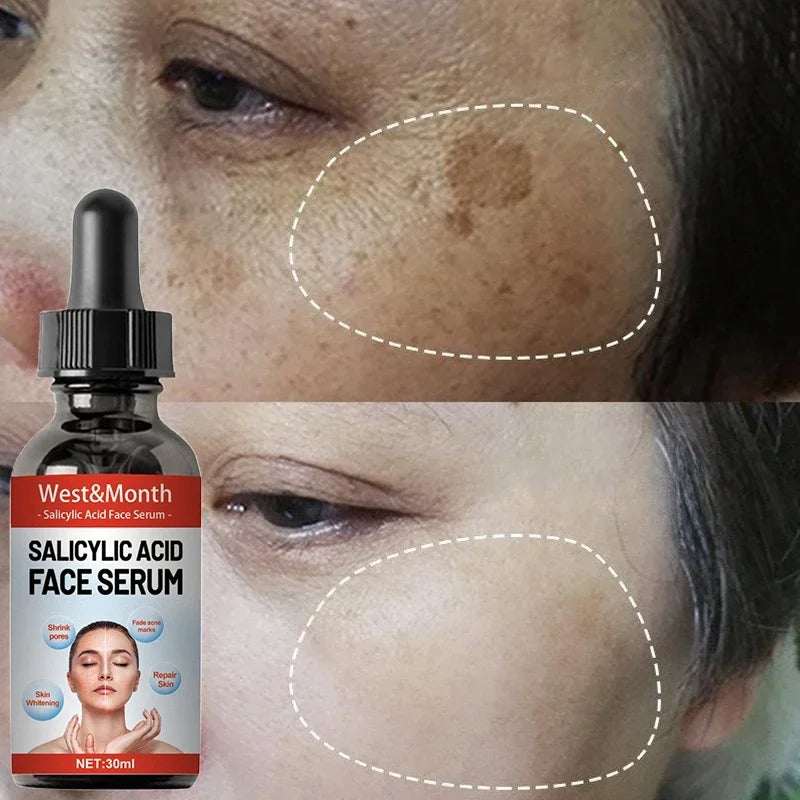 Niacinamide Facial Serum Salicylic Acid Moisturizing Skin Care Products 2024