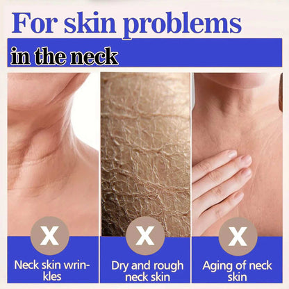 Neck Wrinkles Cream | Collagen Neck Cream | My Store