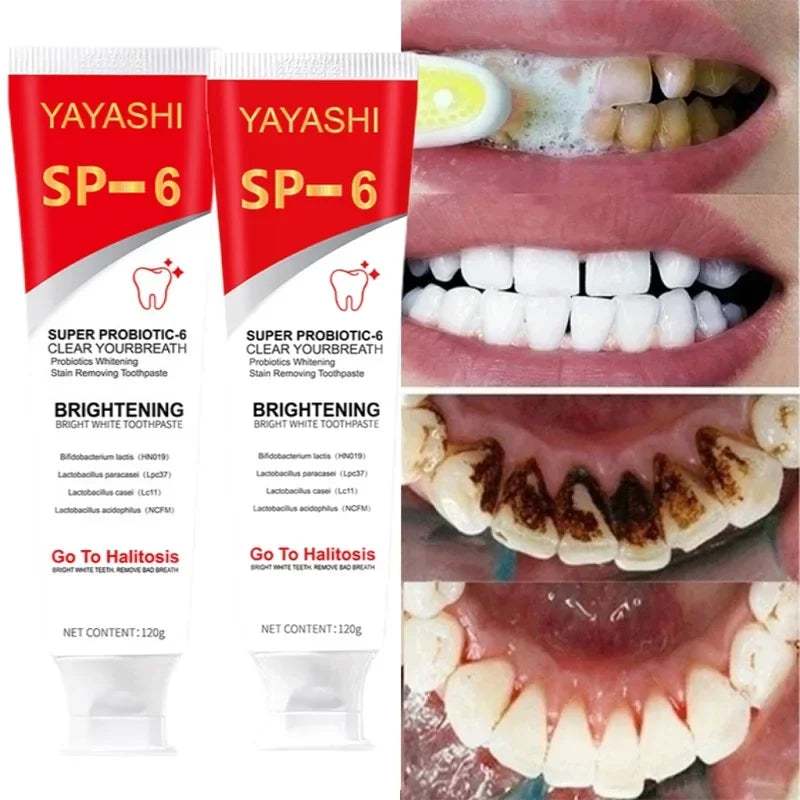 Probiotic Toothpaste SP-6 Whitening Tooth Remove Plaque Stains Teeth Whitener Oral Hygiene Clean Fresh Breath Denta 120G New