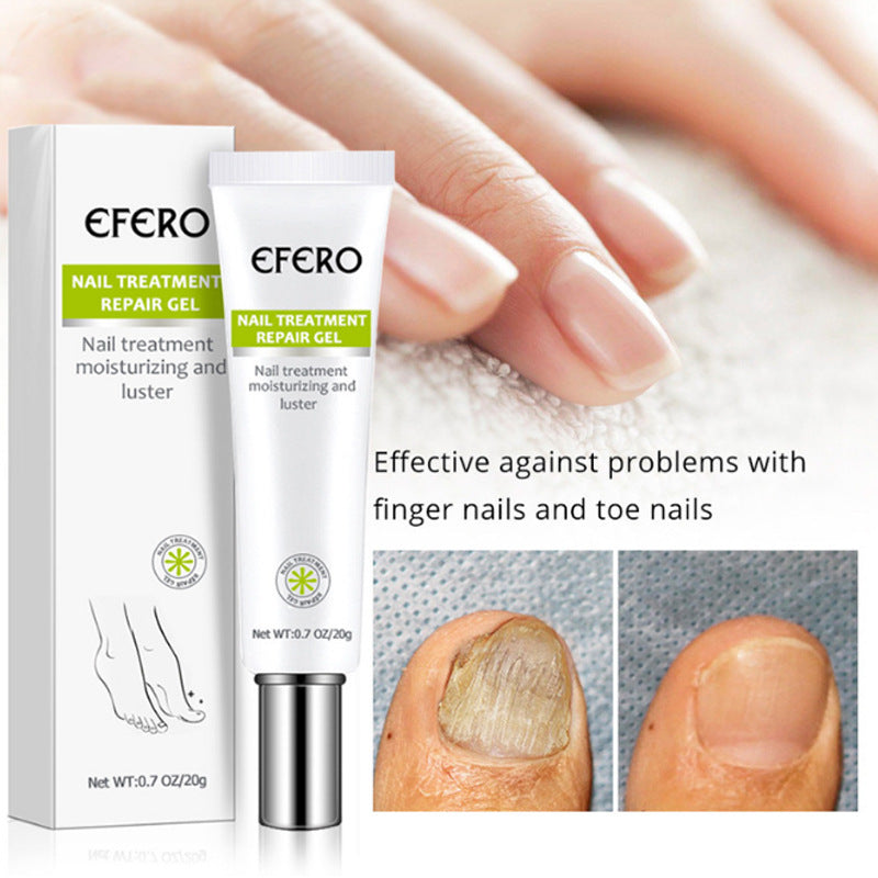 Nail Treatment Serum Nail Foot Nail Fungus Removal Gel