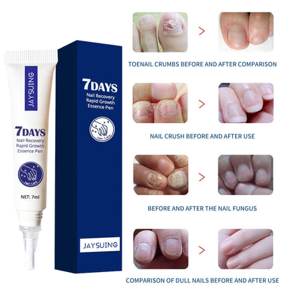 Hand And Foot Nail Care Solution